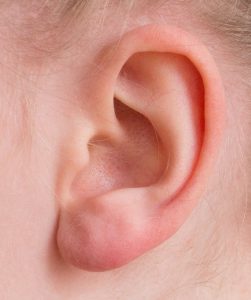 Zánět vnitřního ucha mikrobiální začátku je vytvořen